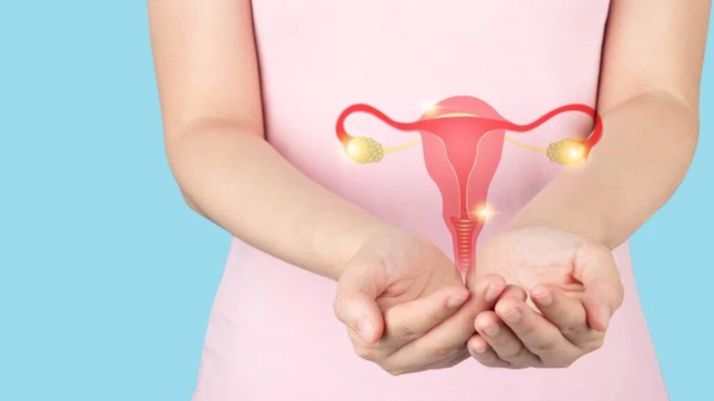 PCOS