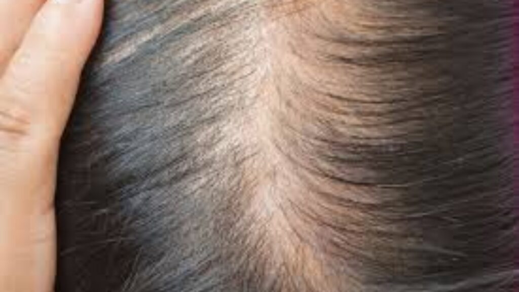 बालों का झड़ना रोके