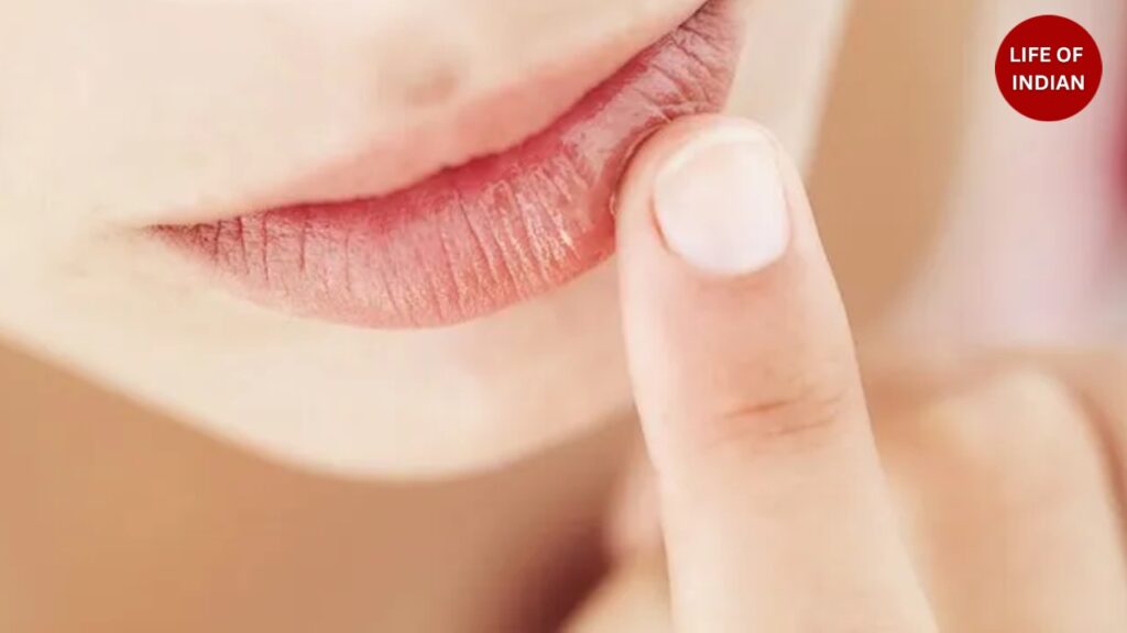 Winter Dry Lips: Causes, Remedies and Natural Care Tips