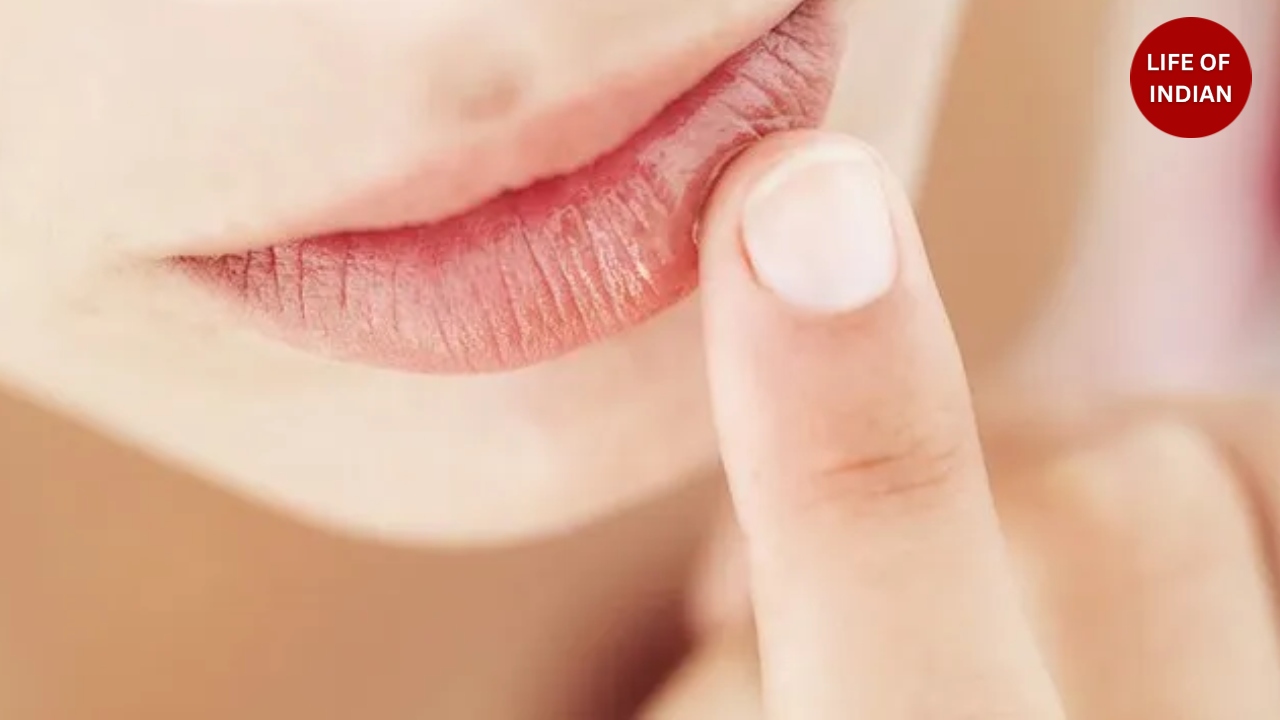 Winter Dry Lips: Causes, Remedies and Natural Care Tips