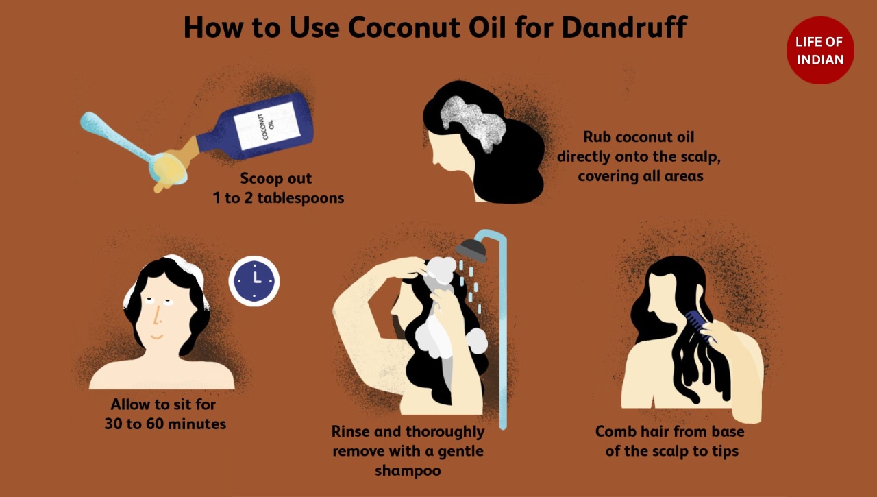 winter dandruff remedy