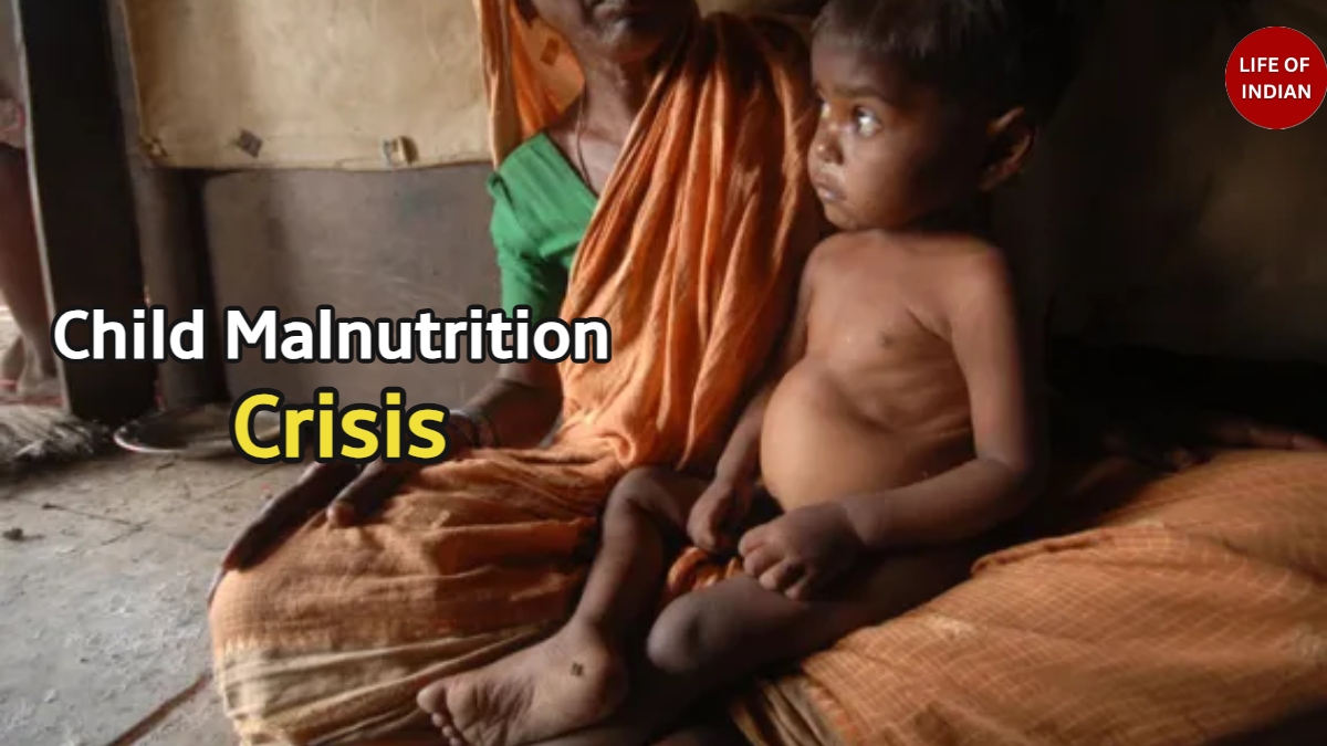Child Malnutrition Crisis
