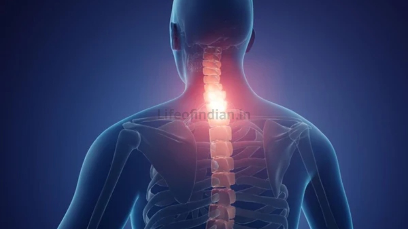 Cervical Spondylosis 2