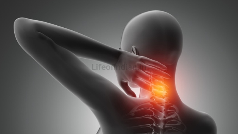 Cervical Spondylosis 3 1