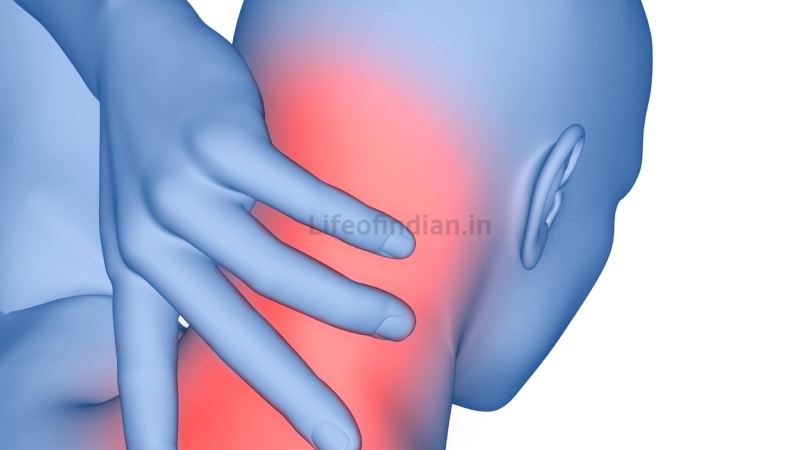 Cervical Spondylosis 6
