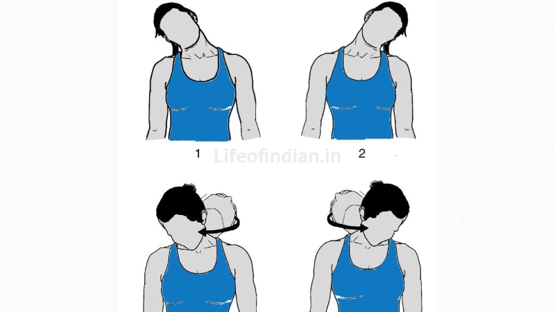 Cervical Spondylosis 8